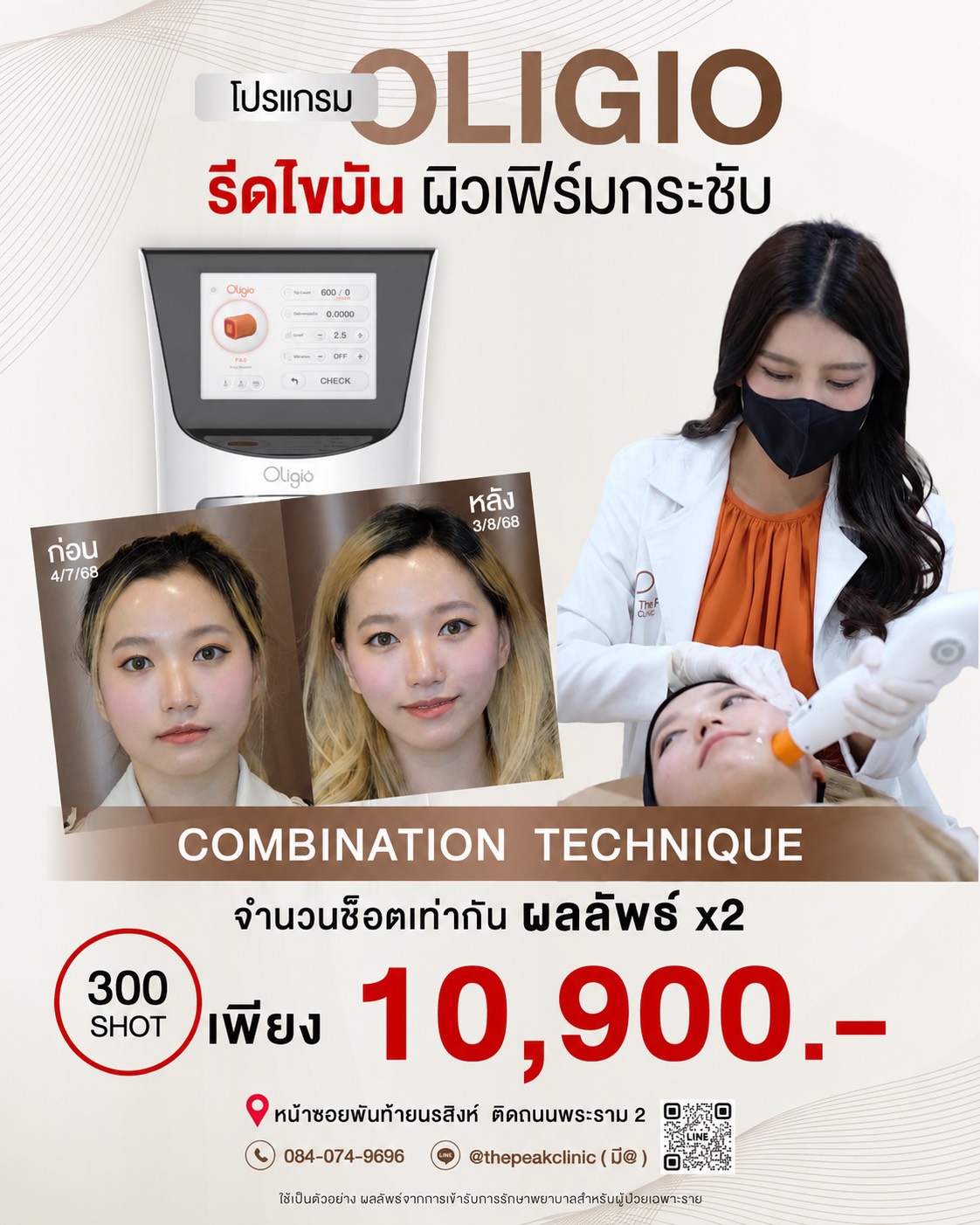 โปรแกรมยกกระชับและสลายไขมัน OLIGIO