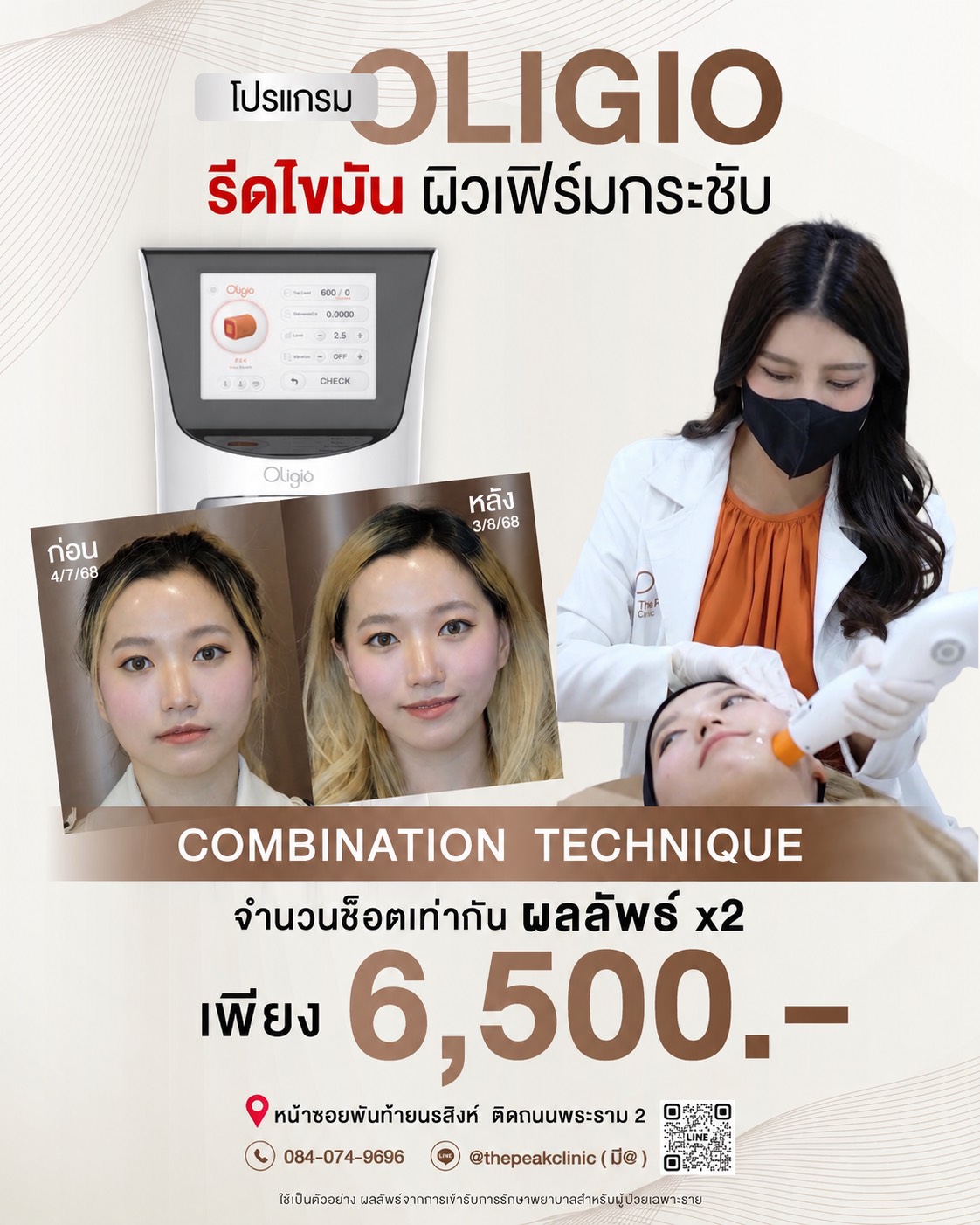โปรแกรมยกกระชับและสลายไขมัน OLIGIO